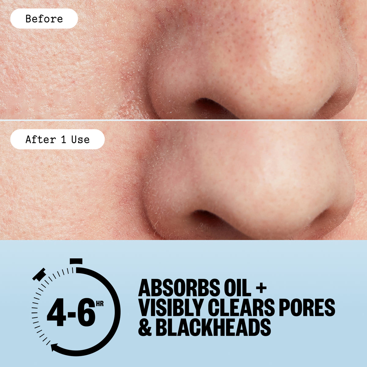 Before-and-after close-up of a nose with fewer blackheads after Peace Out Pore Minimizing Strips.