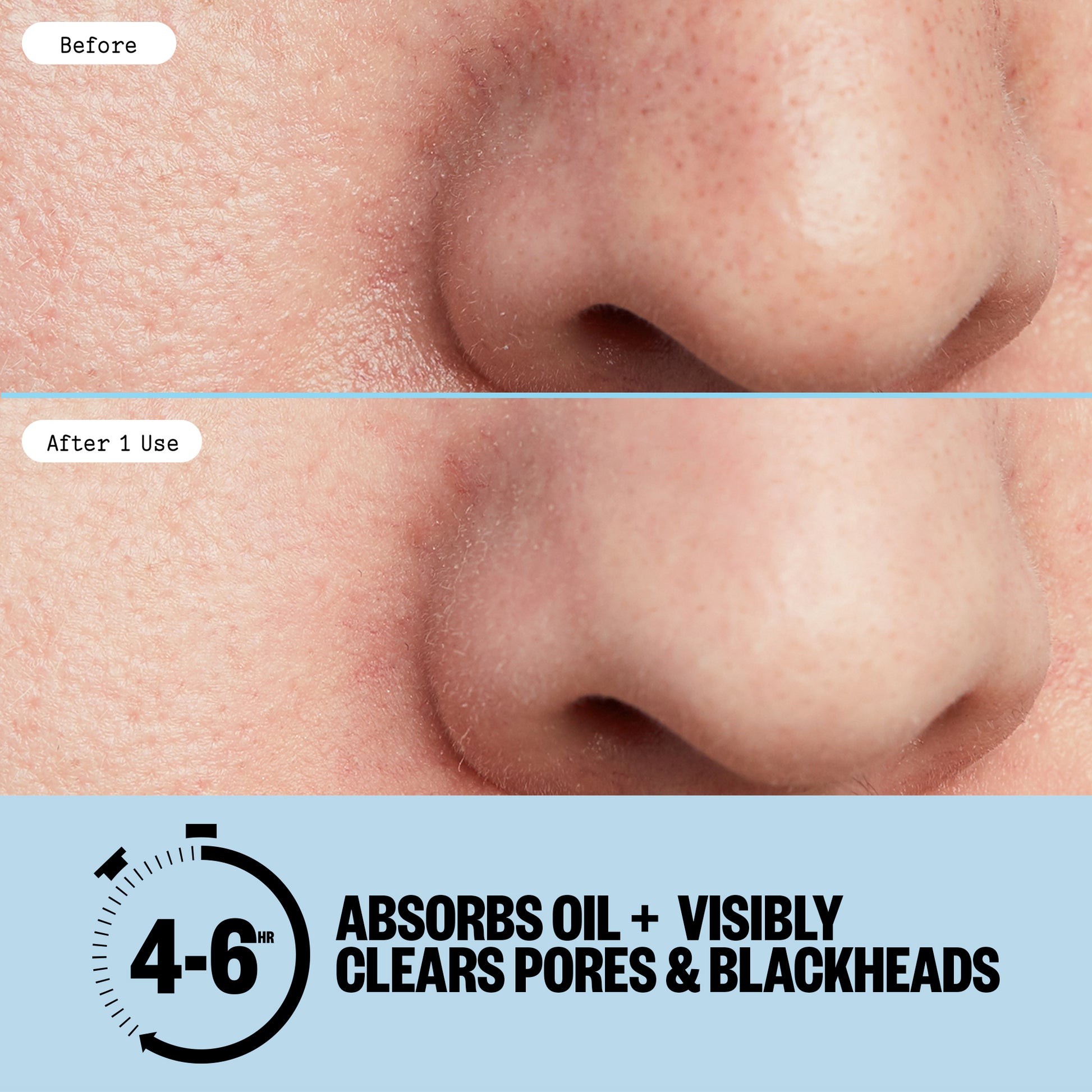 Before and after comparison of a nose with text indicating product effectiveness.