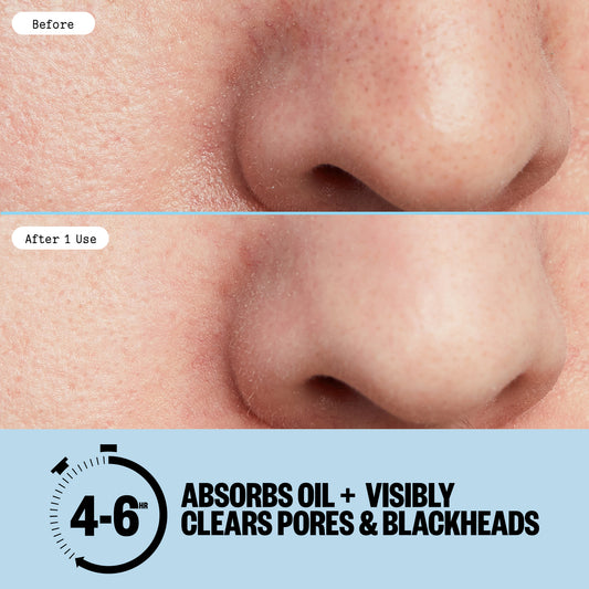Before and after comparison of a nose with text indicating product effectiveness.