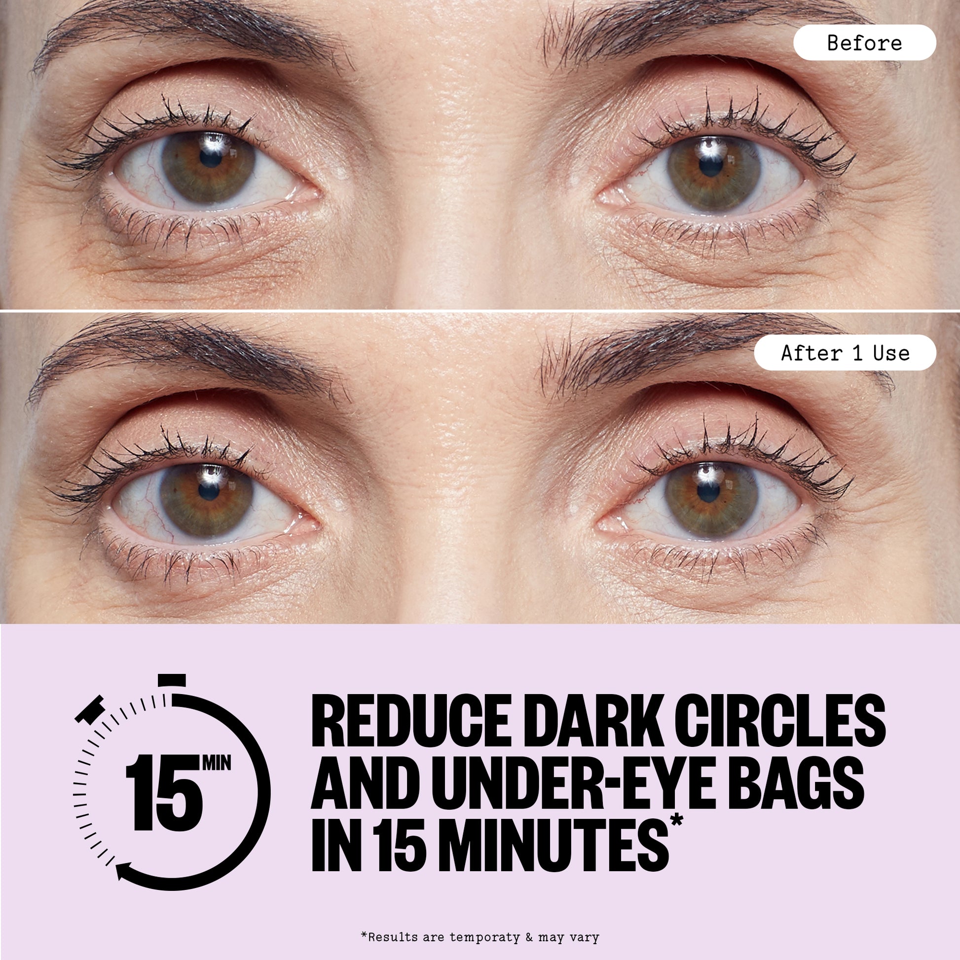 Before and after comparison of eye area treatment with text claiming to reduce dark circles and under-eye bags.