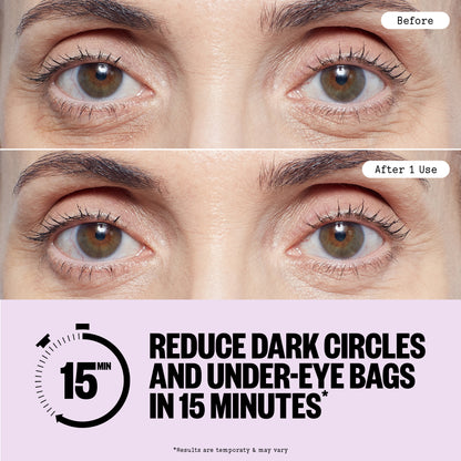 Before and after comparison of eye area treatment with text claiming to reduce dark circles and under-eye bags.