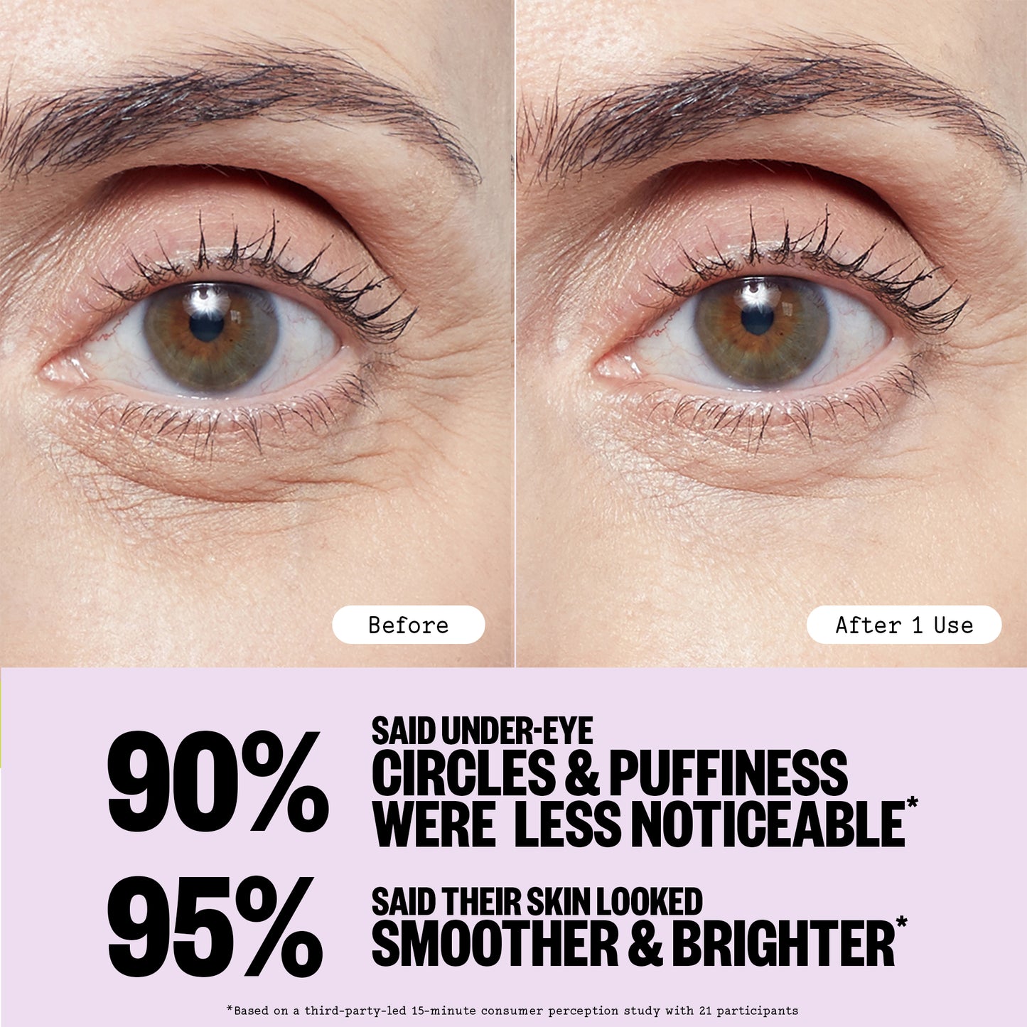 Before and after comparison of eye area with text on a light purple background
