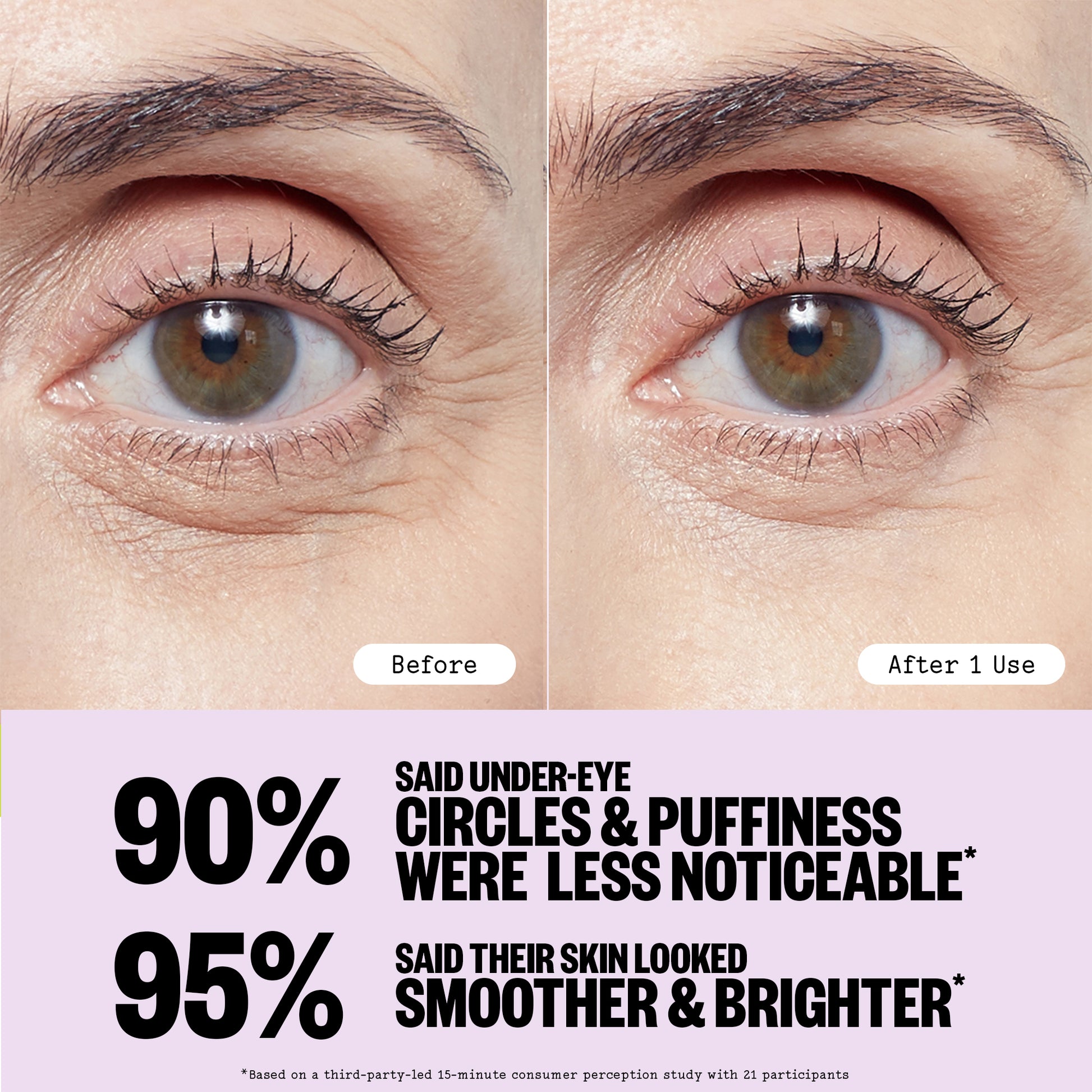 Before and after comparison of eye area with text on a light purple background