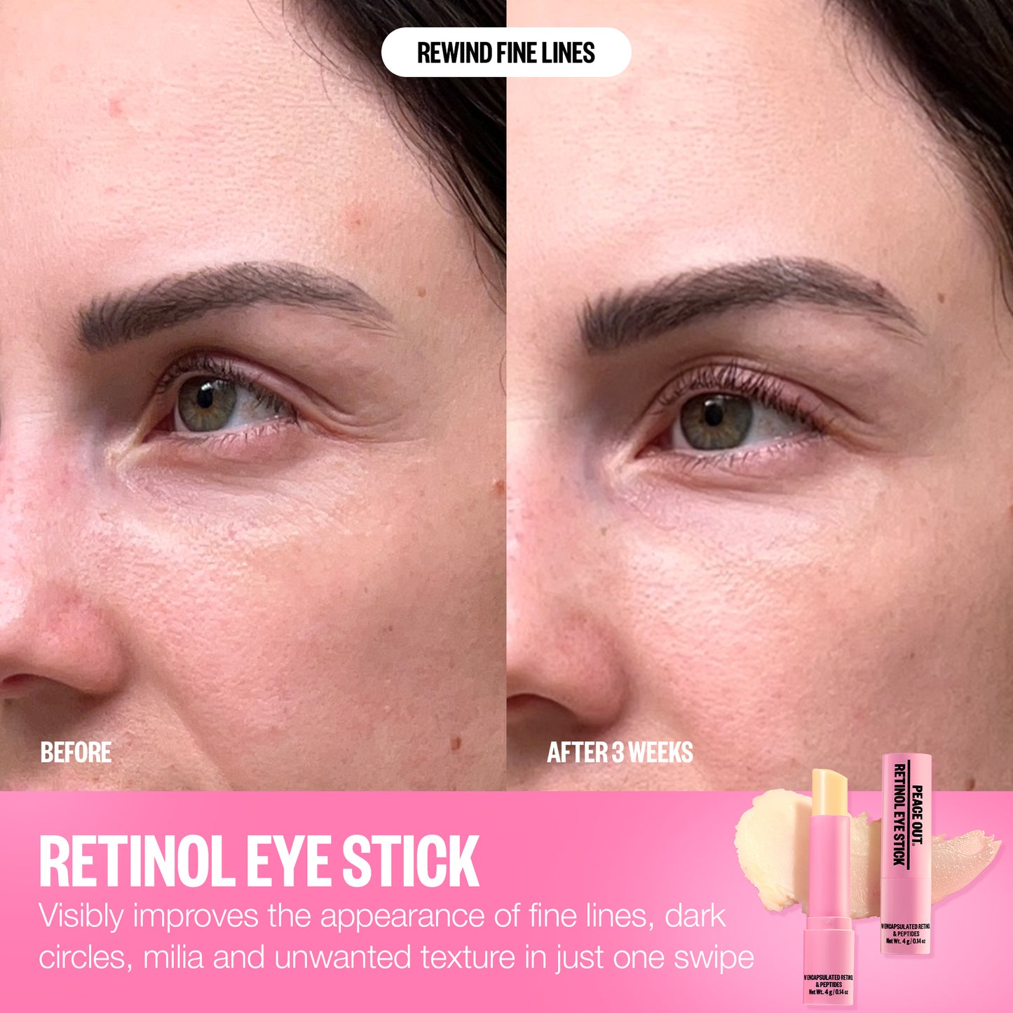 Retinol Eye Stick