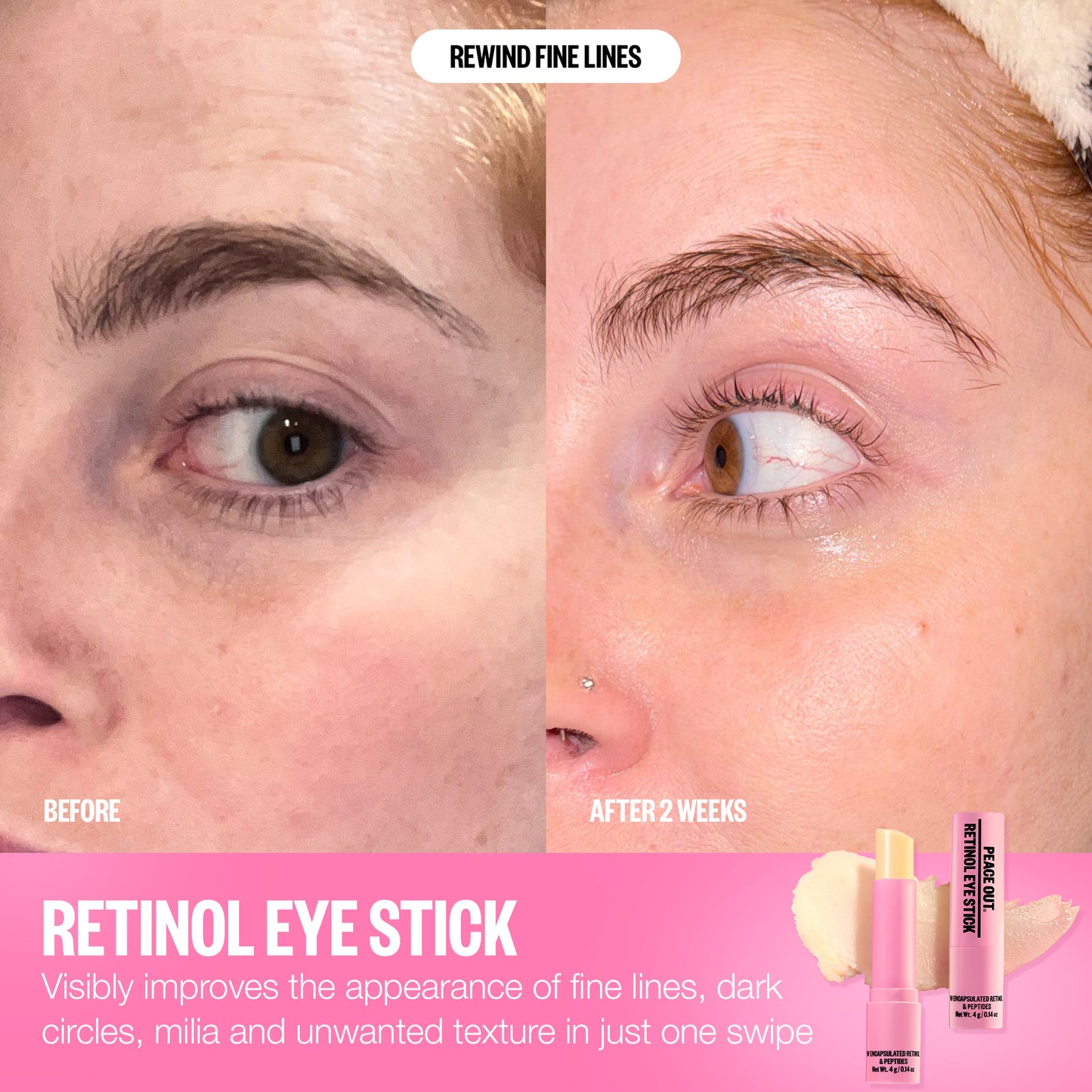 Retinol Eye Stick