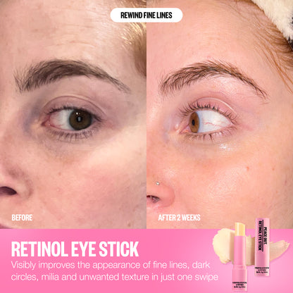 Retinol Eye Stick