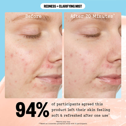 Before-and-after showing soothed skin 20 minutes after Peace Out Redness + Clarifying Mist.