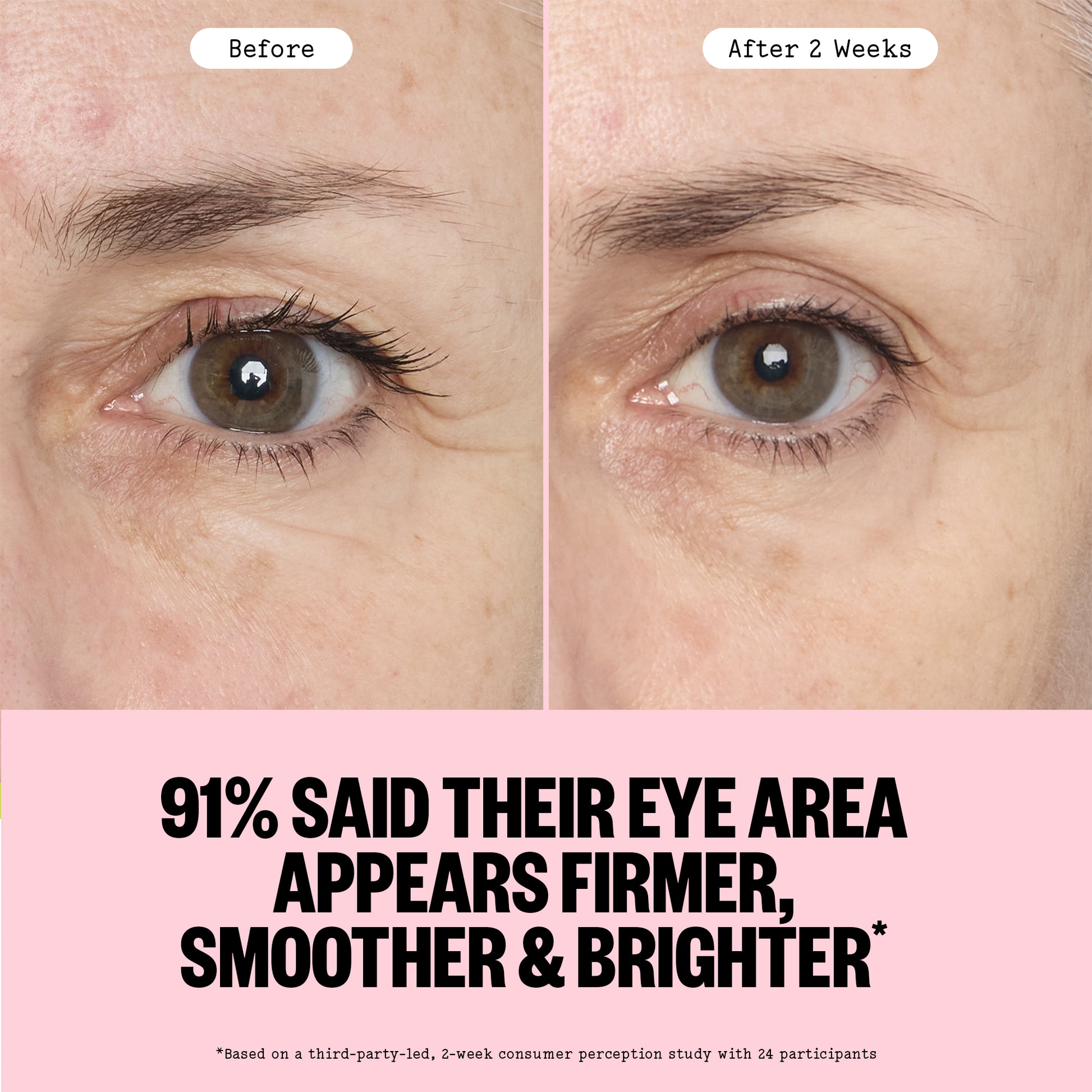 Before and after comparison of eye area treatment showing firmer, smoother, and brighter appearance.
