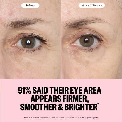 Before and after comparison of eye area treatment showing firmer, smoother, and brighter appearance.