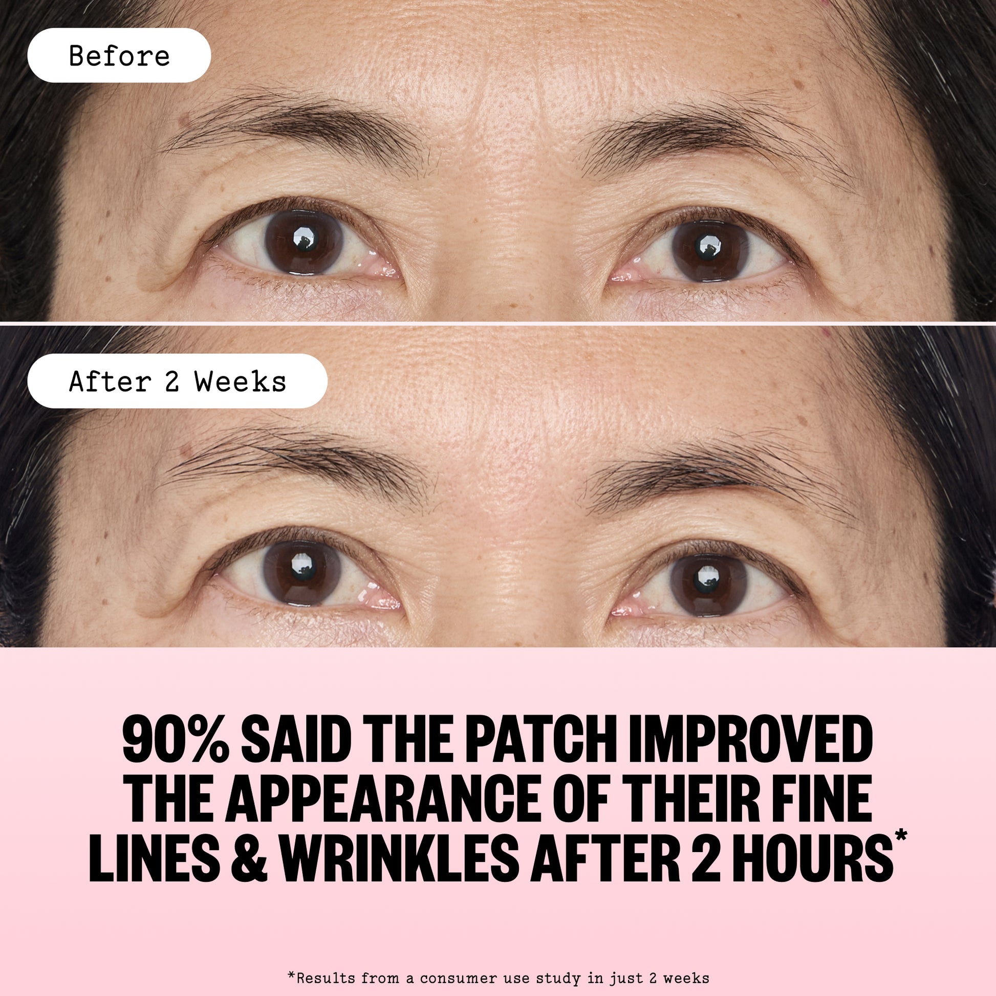 Before-and-after comparison of an older woman's eyes showing improvement in fine lines and wrinkles after 2 weeks, with text stating '90% SAID THE PATCH IMPROVED THE APPEARANCE OF THEIR FINE LINES & WRINKLES AFTER 2 HOURS'.