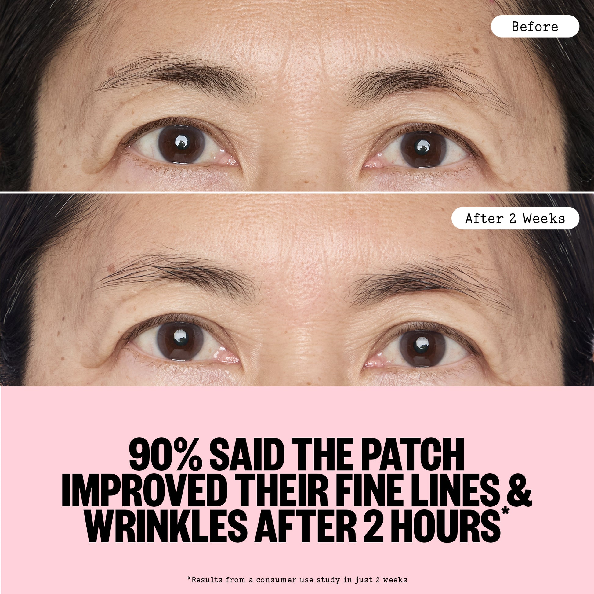 Before and after comparison of a person's eye area with text about a patch improving fine lines and wrinkles.