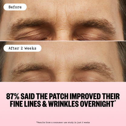 Before-and-after comparison of a man's forehead and eyebrows, with the top labeled 'Before' and the bottom labeled 'After 2 Weeks'. The lower portion features a pink banner with the text '87% SAID THE PATCH IMPROVED THEIR FINE LINES & WRINKLES OVERNIGHT'.