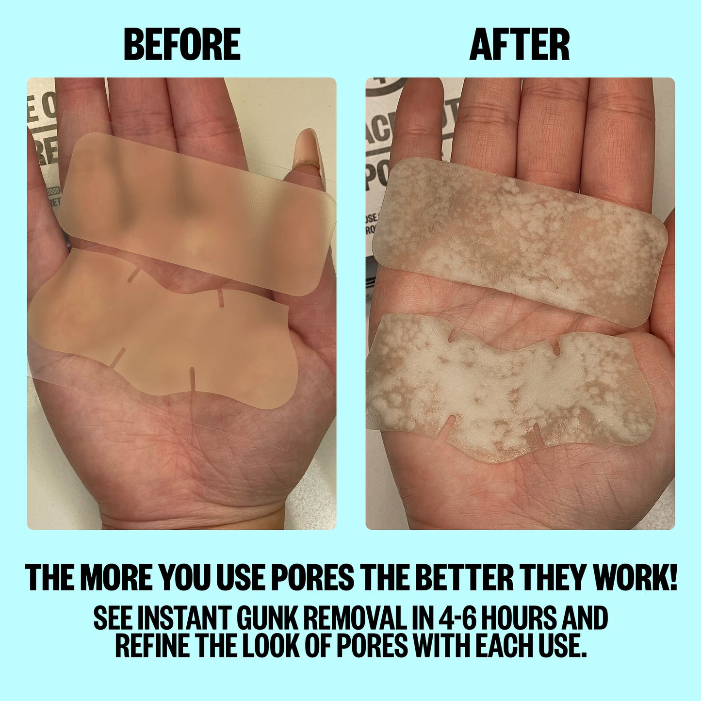 Pore Minimizing Strips